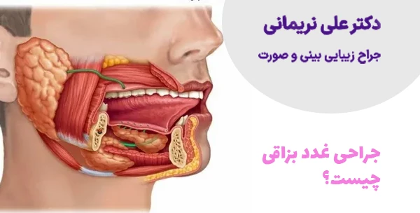 جراحی غدد بزاقی چیست؟