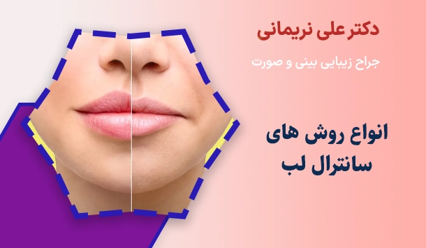 انواع روش های سانترال لب