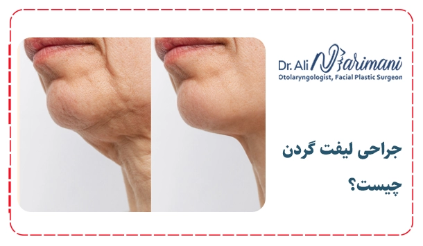 جراحی لیفت گردن چیست؟