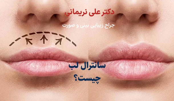 سانترال لب چیست؟