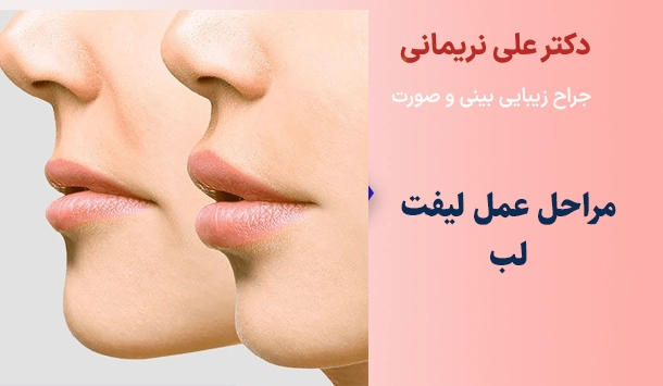 مراحل عمل لیفت لب