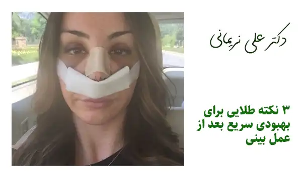 3 نکته طلایی برای بهبودی سریع بعد از عمل بینی