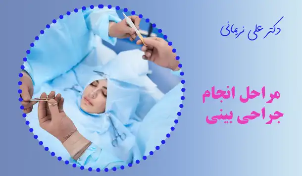 مراحل انجام جراحی بینی
