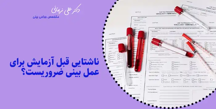 ناشتایی قبل آزمایش برای عمل بینی ضروریست؟