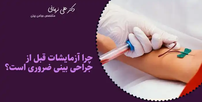 چرا آزمایشات قبل از جراحی بینی ضروری است؟