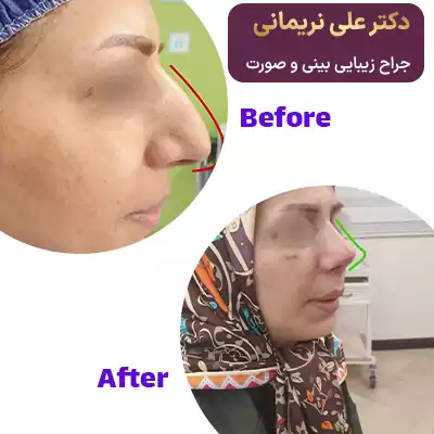 نمونه عمل بینی