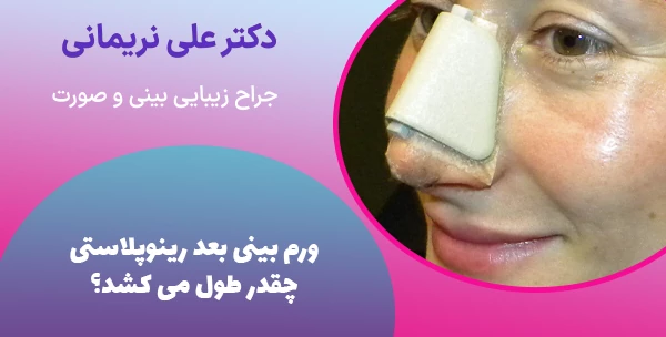 ورم بینی بعد رینوپلاستی چقدر طول می کشد؟