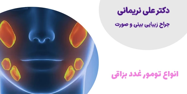 انواع تومور غدد بزاقی