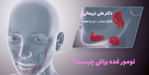 تومور غده بزاقی چیست؟