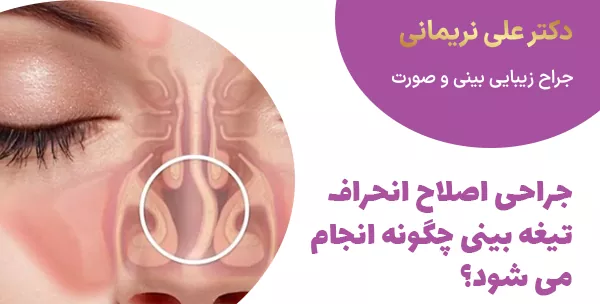 جراحی اصلاح انحراف تیغه بینی چگونه انجام می شود؟