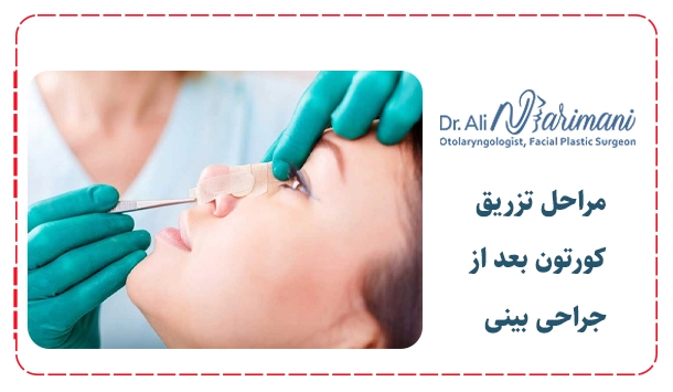 مراحل تزریق کورتون بعد از جراحی بینی