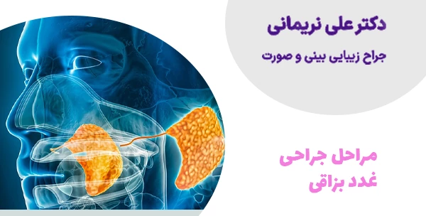مراحل جراحی غدد بزاقی