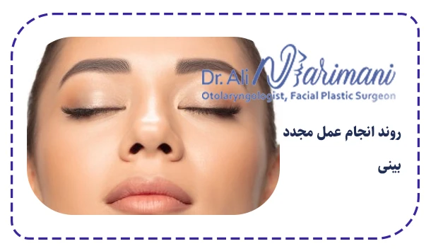 روند انجام عمل مجدد بینی