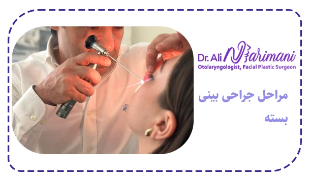 مراحل جراحی بینی بسته
