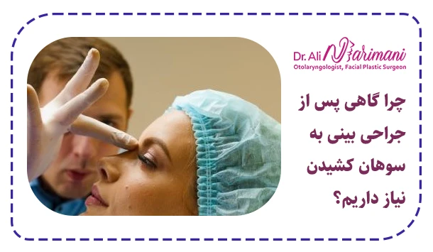 چرا گاهی پس از جراحی بینی به سوهان کشیدن نیاز داریم؟