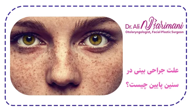 علت جراحی بینی در سنین پایین چیست؟