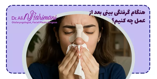 هنگام گرفتگی بینی بعد از عمل چه کنیم؟