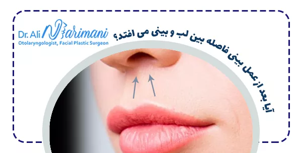 آیا بعد از عمل بینی فاصله بین لب و بینی می افتد؟
