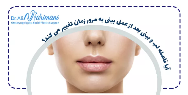 آیا فاصله لب و بینی بعد از عمل بینی به مرور زمان تغییر می کند؟