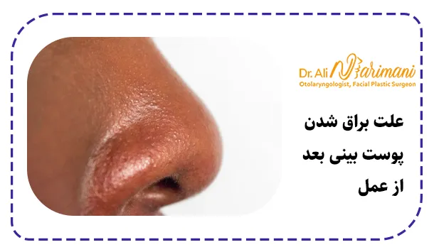 علت براق شدن پوست بینی بعد از عمل