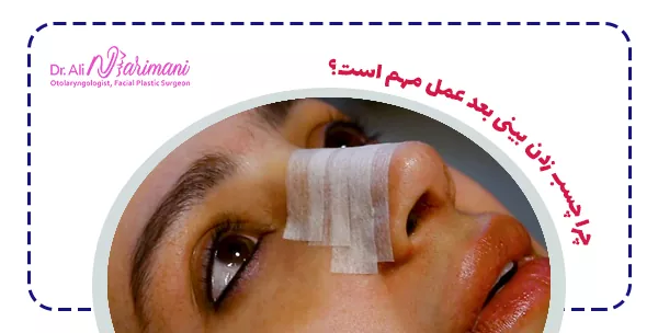 چرا چسب زدن بینی بعد عمل مهم است؟