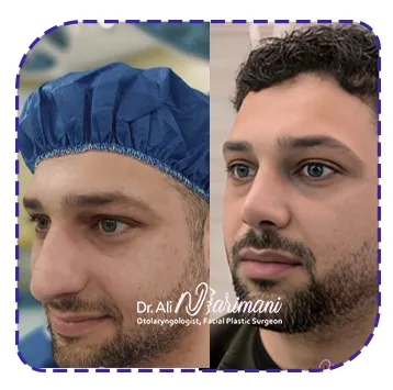 نمونه کار دکتر علی نریمانی